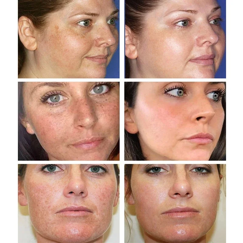 Effective Whitening Freckles C - Licorice Root Sticks 评论和价格