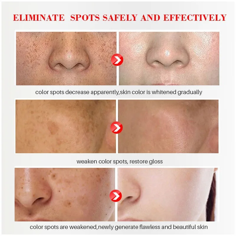 Effective Whitening Freckles C - Licorice Root Sticks 评论和价格