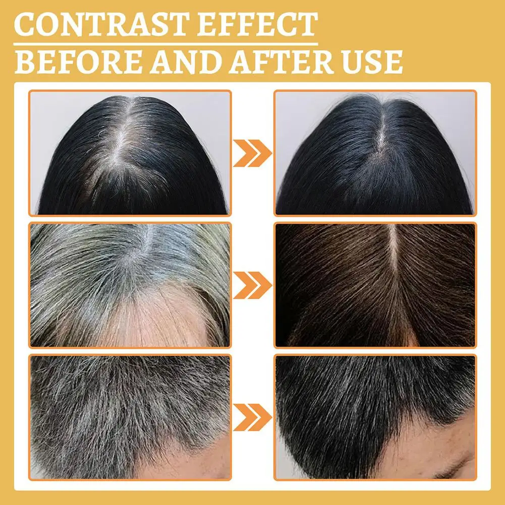 3Pcs Grey Hair Reverse Serums  - Licorice Root Sticks 评论和价格