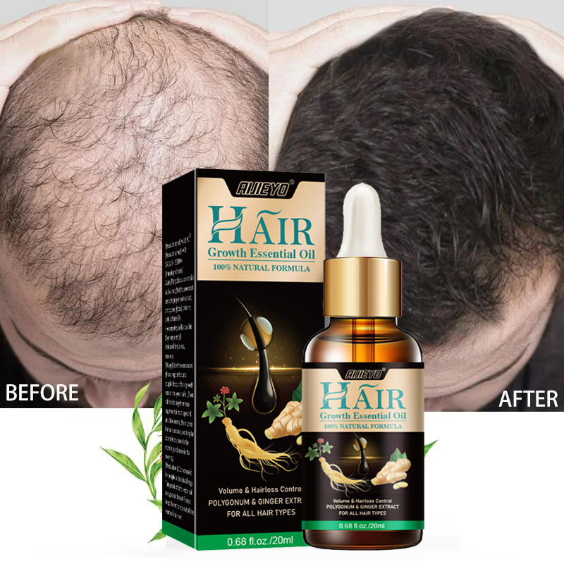 2023 Biotin Fast Hair Growth O - Licorice Root Sticks 评论和价格