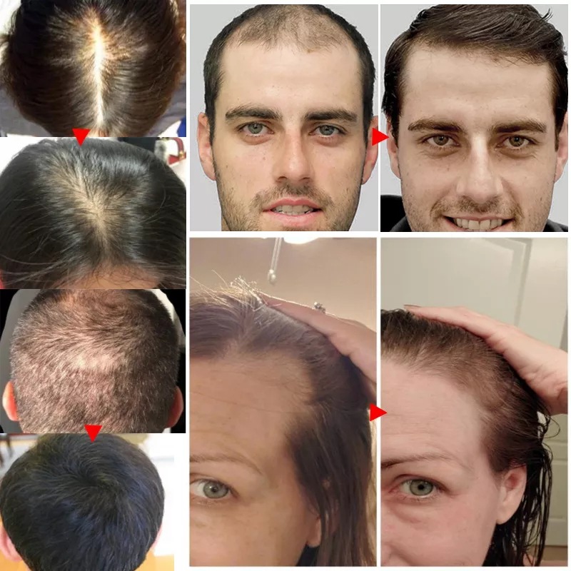 2023 Biotin Fast Hair Growth O - Licorice Root Sticks 评论和价格