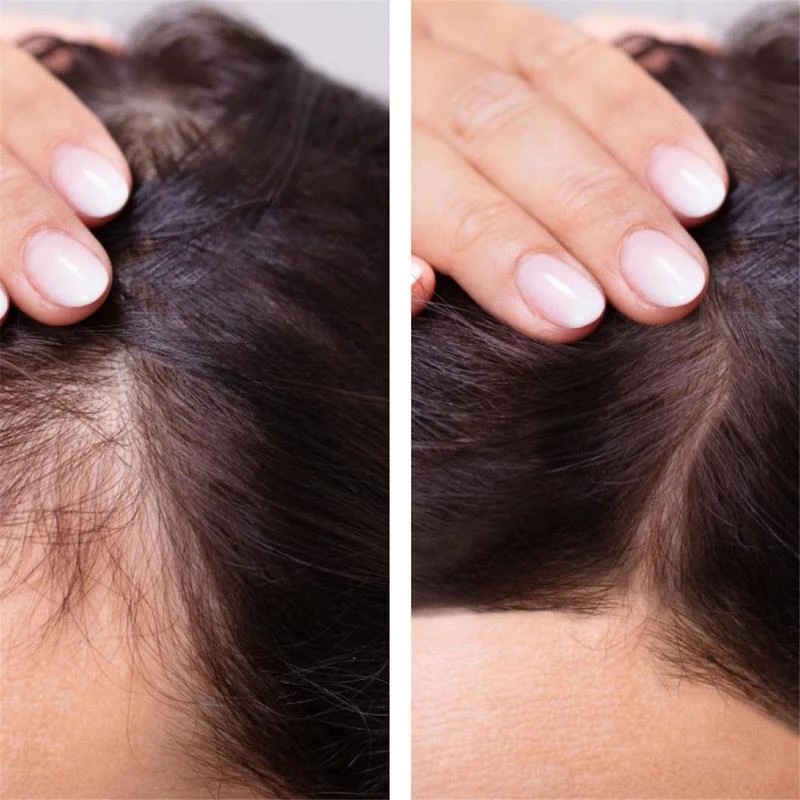2023 Biotin Fast Hair Growth O - Licorice Root Sticks 评论和价格