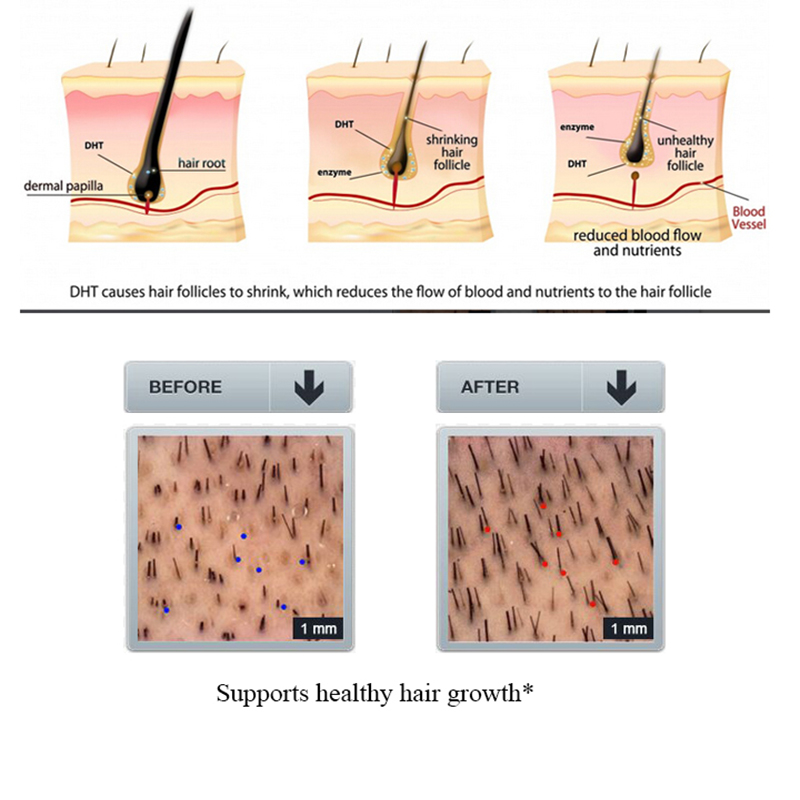 PURC 100ml Ginger Hair Loss Sh - Licorice Root Sticks 评论和价格