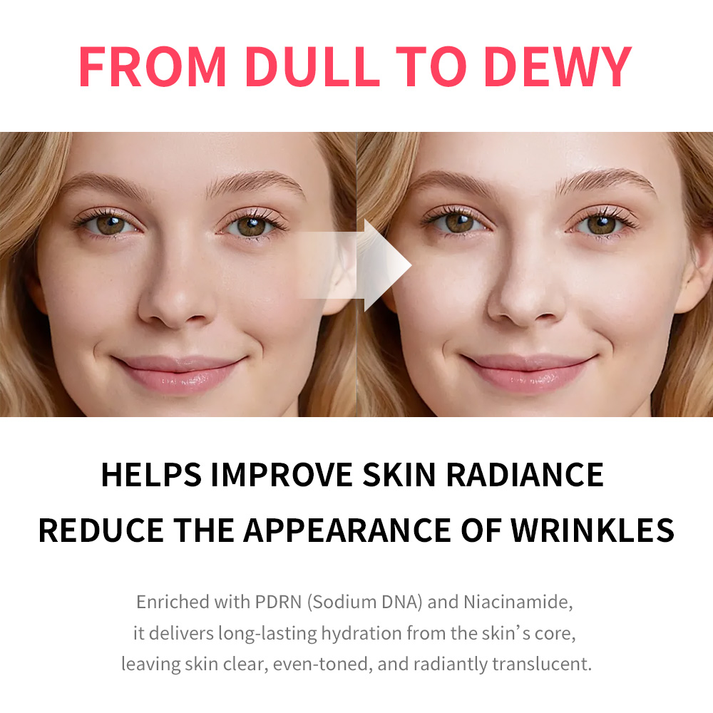 PDRN Pink Niacinamide Milky To - Echinacea 评论和价格
